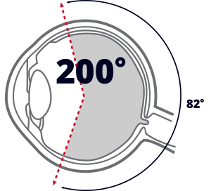 optomap retinal imaging vs dilation